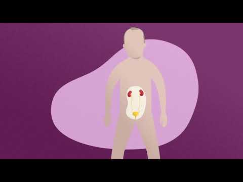 Video: Cáncer de vejiga: síntomas, opciones de tratamiento y pronóstico