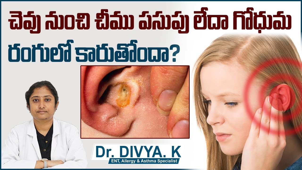 చెవు నుంచి చీము Otitis media Infection In Middle Ear Middle Ear Infection Sankhya