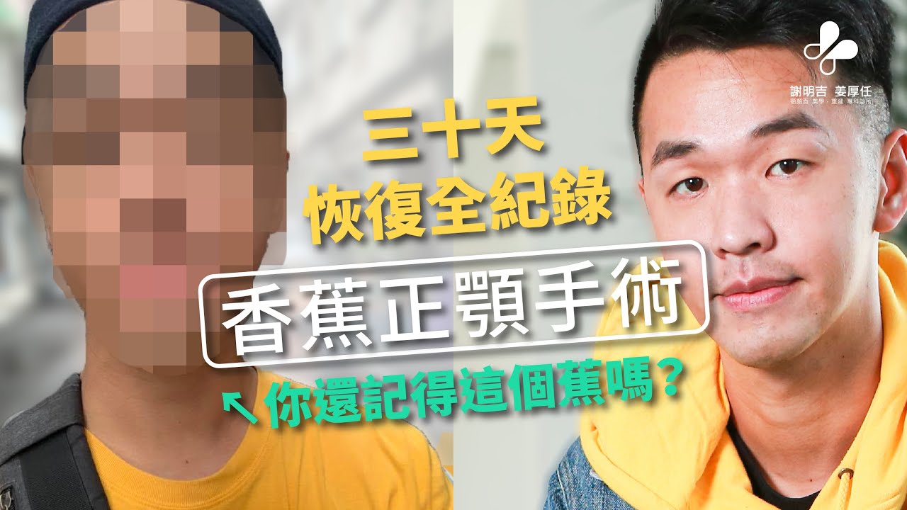 問題 快要做正顎 恢復期真的有這麼快嗎 看板teeth Salon 批踢踢實業坊