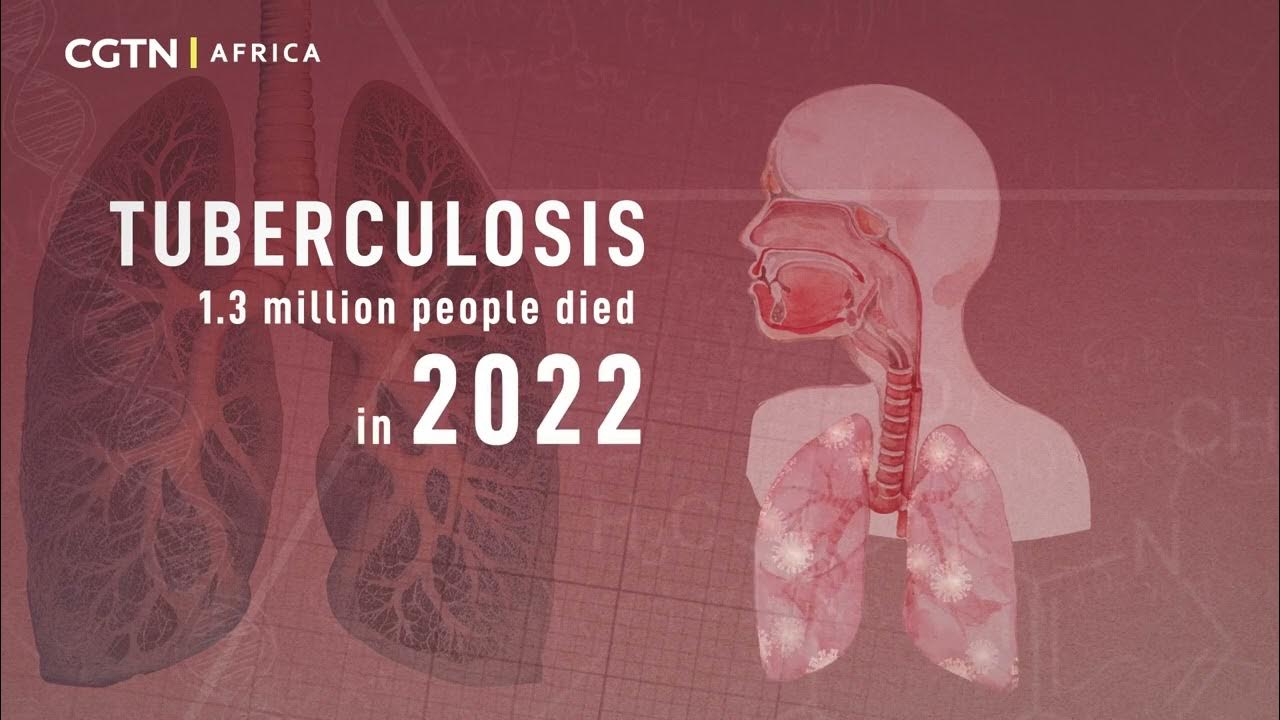 The world marks Tuberculosis day