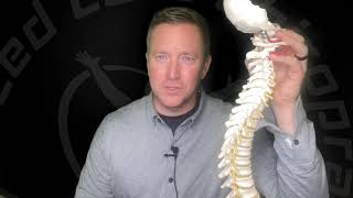 What is Torticollis?
