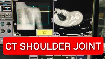 Shoulder Joint CT scan Protocol, Positioning & Planning
