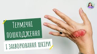 Термічні пошкодження і захворювання шкіри