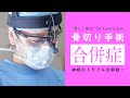 骨切り手術の合併症『神経損傷のお話』