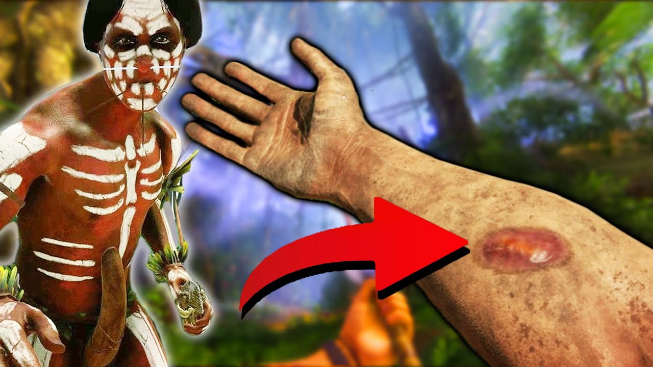 MÁM TO POD KŮŽÍ A HÝBE SE TO 🤮 | Green Hell #2