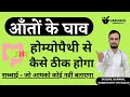 Ulcerative colitis homeopathic treatment in hindi  ulcerative colitis homeopathic treatment