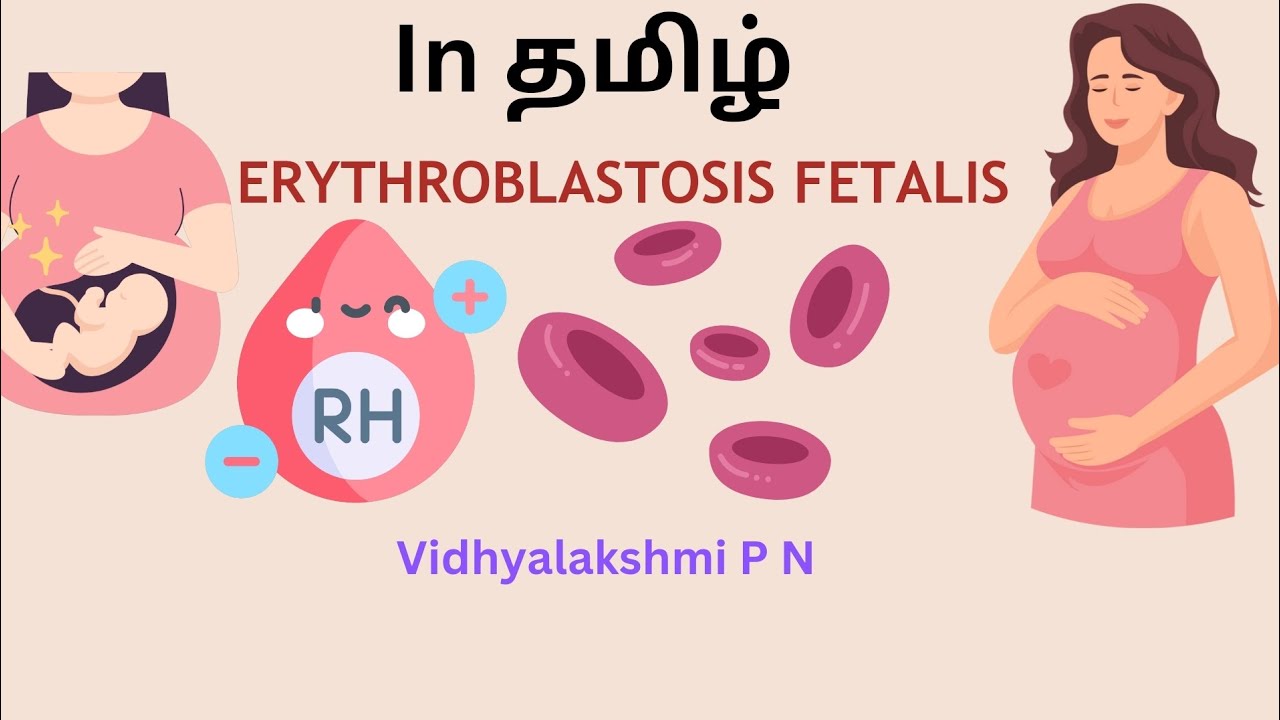 Rh incompatibility in tamil,