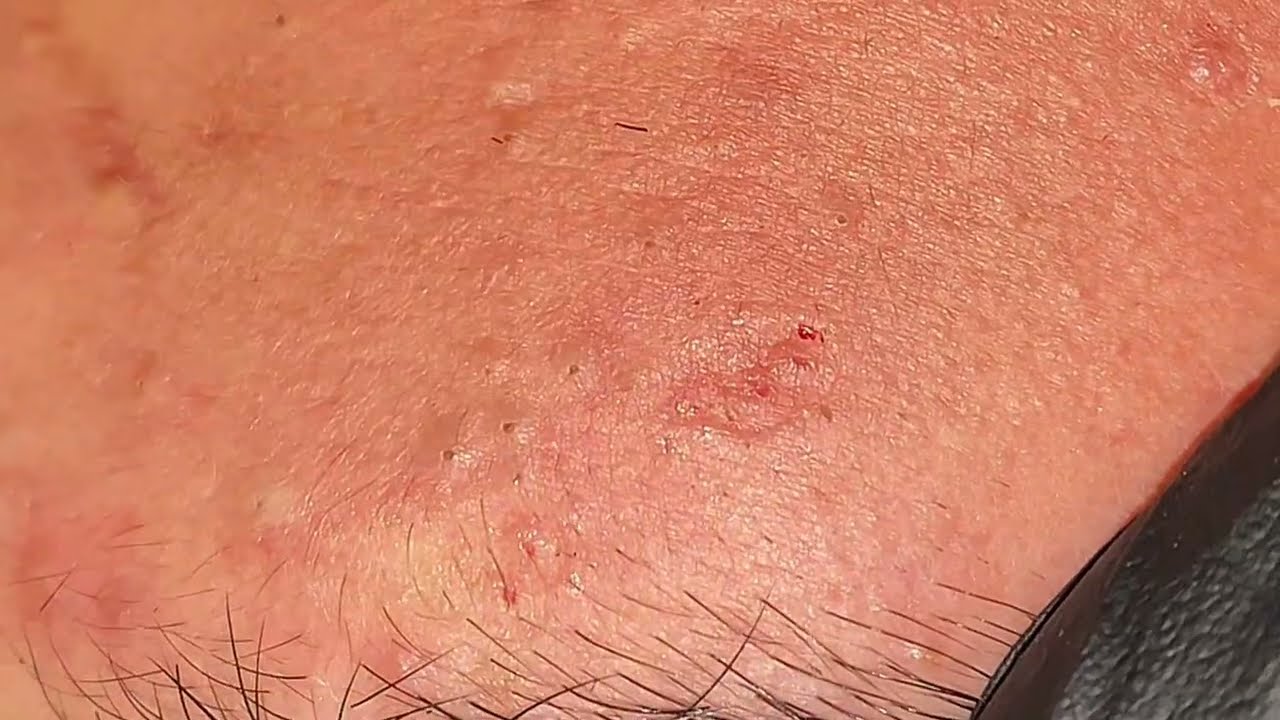 Skincare satisfying videos by Mahmoud Gamal #2005
