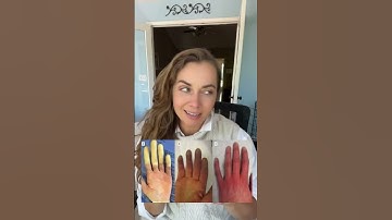 What is Raynaud’s? Learn more about this mysterious condition.  #raynauds #autoimmune #rarediseases