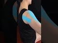 Taping For Collar Bone Fracture. Comment "Tape" Below To Unlock Our Masterclass.