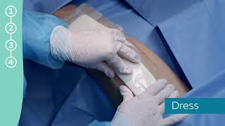 Application of the PICO System after knee surgery screenshot 4