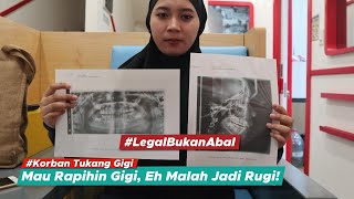 Nyesel Banget Akibat Pasang Behel Yang Tidak Dilakukan Oleh Ahlinya