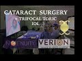 Cataract surgery  fine vision trifocal toric iol  ngenuity  verion   santiago martinez md