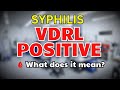VDRL TPHA Positive Treatment in Urdu | VDRL Test Kya Hota Hai | VDRL Negative Kaise Hota Hai