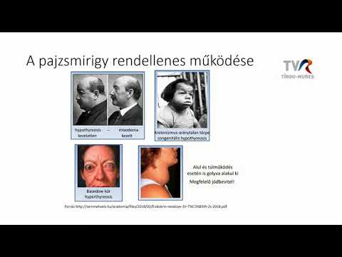 Videó: 6 Természetes Gyógymód A Hormonok Kiegyensúlyozására + Okok, Tünetek és Megelőzési Tippek