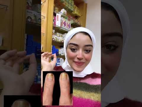 زيت طبيعي يقضي علي فطريات الاظافر