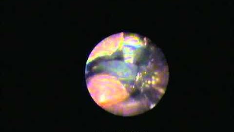 Semi Rigid Endoscope 1.0mm diameter Fibrescope - video image RVA Synergies Ltd