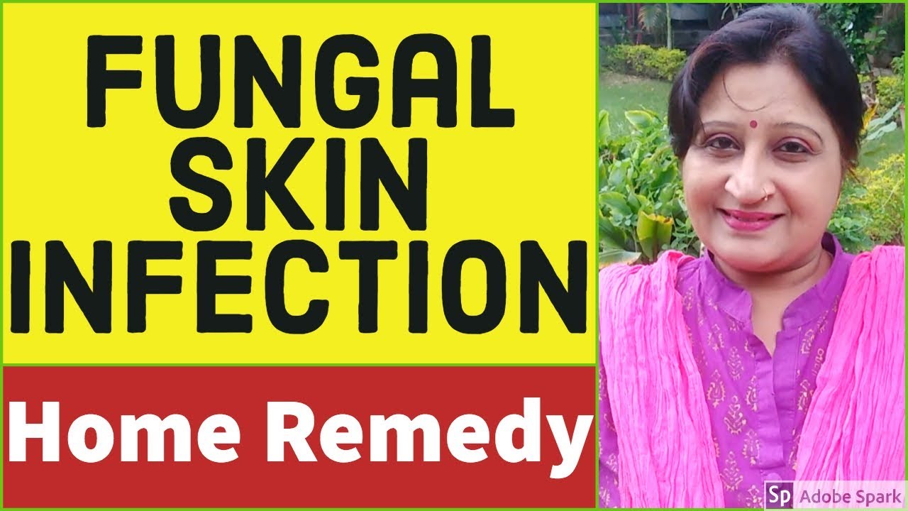 Skin Fungal Infection Treatment | Skin Infection | How to ...