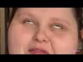 Amber Reid lying and contradicting herself for 9 minutes straight | 500 lbs then vs now