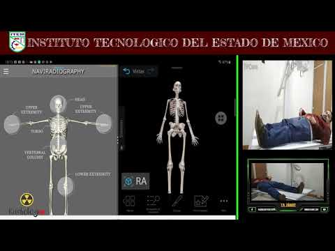 Sala rx y