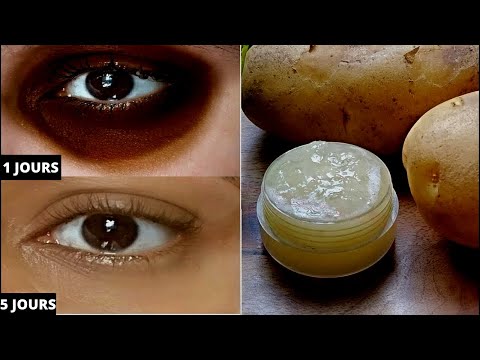 Vidéo: Pommes De Terre Et Concombres: 5 Méthodes De Modèles Célèbres Pour Aider à Se Débarrasser Des Poches Sous Les Yeux