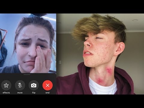 hickey-prank-on-girlfriend!-*gone-wrong*