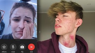 Hickey Prank On Girlfriend! *GONE WRONG*