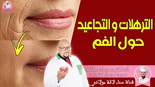 التخلص من الترهلات والتجاعيد حول الفم مع الدكتور عماد ميزاب Dr imad mizab