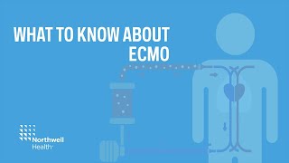 ECMO: 8 common questions answered
