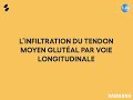 Plasma riche en plaquettes prp pour tendinopathie du moyen glutal moyen fessier