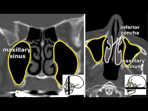 Vídeo: Com Utilitzar Petxines A L'interior