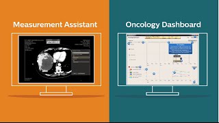 Clinical Context Applications: Oncology Dashboard & Measurement Assistant