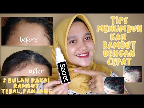 TIPS RAMBUT DI DAHI TUMBUH CEPAT | Tria Wulandari