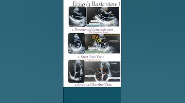 Basic echo view and heart parts #echo #shorts