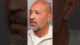 Weekend Lift Before & After Results #facelift #weekendlift