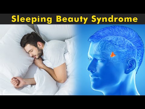 Video: Wat Is Sleeping Beauty Syndrome: Oorzaken, Symptomen, Behandeling?