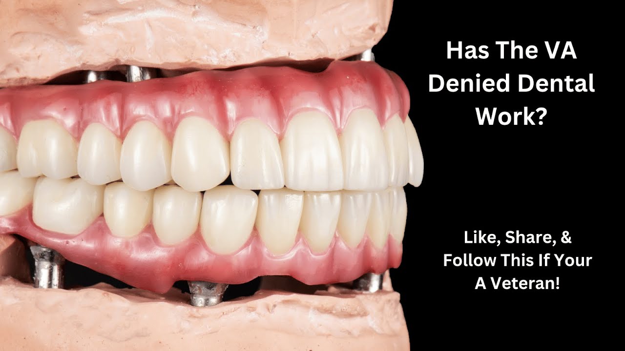 VA Dental Program A System Failing Our Veterans