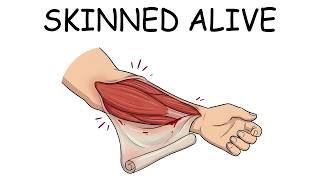 What Getting Skinned Alive Feels Like