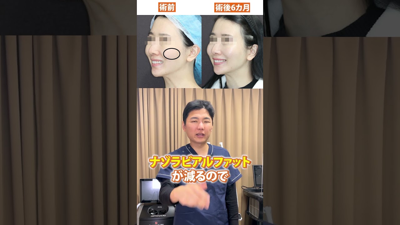 The small face magic will make you feel more excited than ever