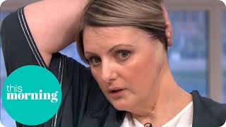 The Woman Who Lost Her Ear to Tanning Addiction | This Morning