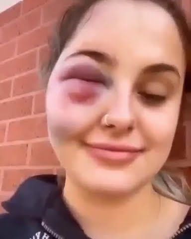 Before it’s banned - YouTube