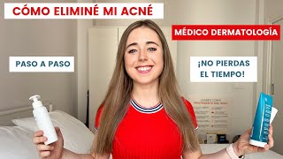 CÓMO ELIMINÉ MI ACNÉ, PASO A PASO | MÉDICO DERMATOLOGÍA | CÓMO QUITAR EL ACNÉ, TRATAMIENTO Y RUTINA