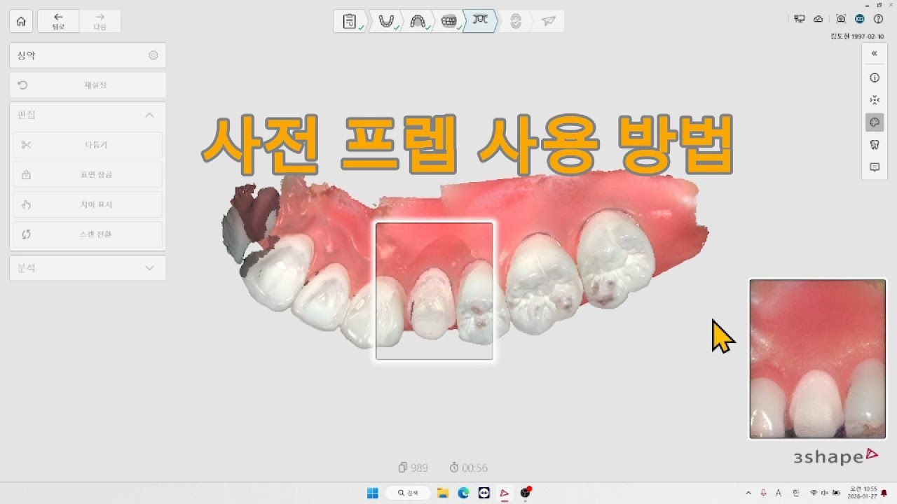 사전 프렙 사용 방법