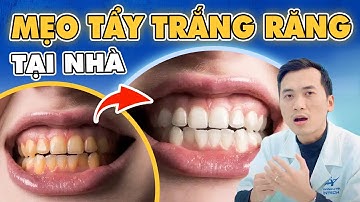 3 Cách Tẩy Trắng Răng Tại Nhà: Mẹo Đơn Giản Nhưng Trắng Bật Tông Chỉ Sau 1 Lần!