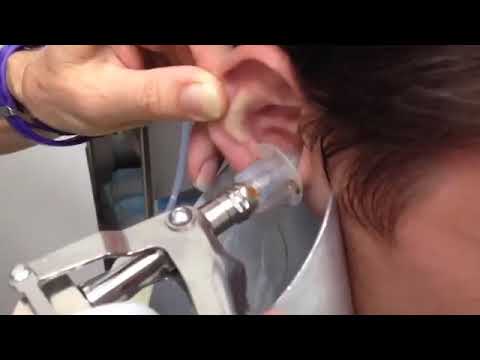 Video: Cum se elimină ceara urechii dintr-un aparat auditiv (cu imagini)