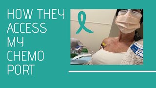 Port Use for Third Chemotherapy Treatment & blood draw  My Cancer Journey Vlog #16 October 13, 2022