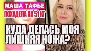 Лишняя кожа. Что стало с моей кожей после похудения на 51 кг