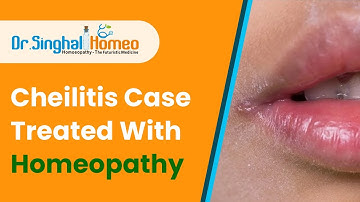 What is Cheilitis ? and Homeopathic Treatment for Cheilitis - Dr. Singhal Homeo Chandigarh