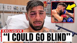 Ilia Topuria's Last Health Update Has UFC Fans Extremely Worried