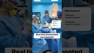 Direct anterior Hip replacement-Uncemented cup impaction #totalhipreplacement